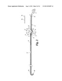 VASCULAR SUTURING DEVICE diagram and image