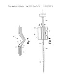 VASCULAR SUTURING DEVICE diagram and image