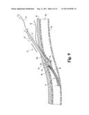 VASCULAR SUTURING DEVICE diagram and image