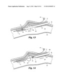 VASCULAR SUTURING DEVICE diagram and image