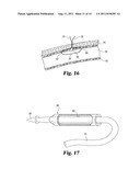 VASCULAR SUTURING DEVICE diagram and image