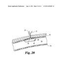 VASCULAR SUTURING DEVICE diagram and image