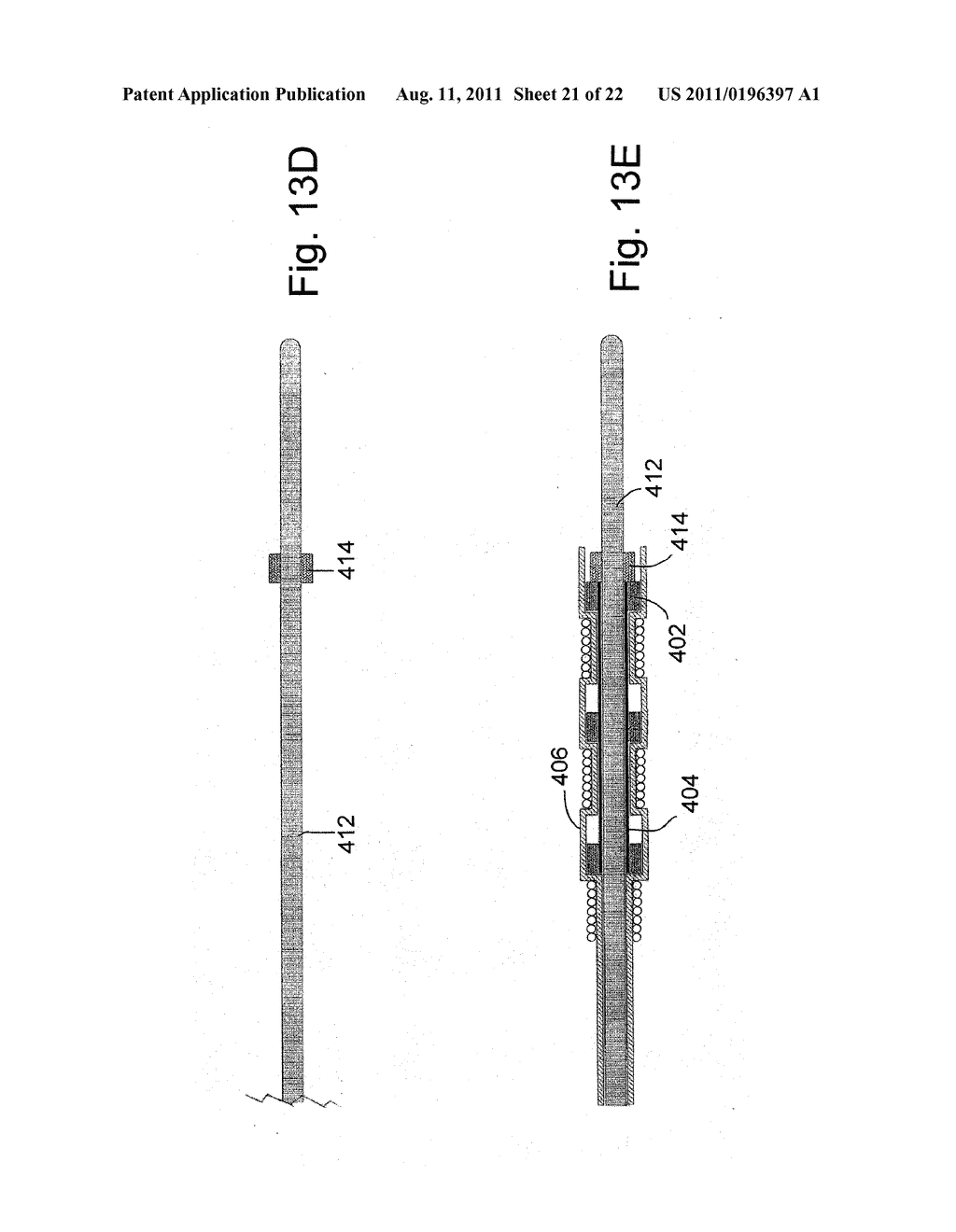 MEDICAL DEVICE WITH A GUIDEWIRE FOR PENETRATING OCCLUSIONS - diagram, schematic, and image 22