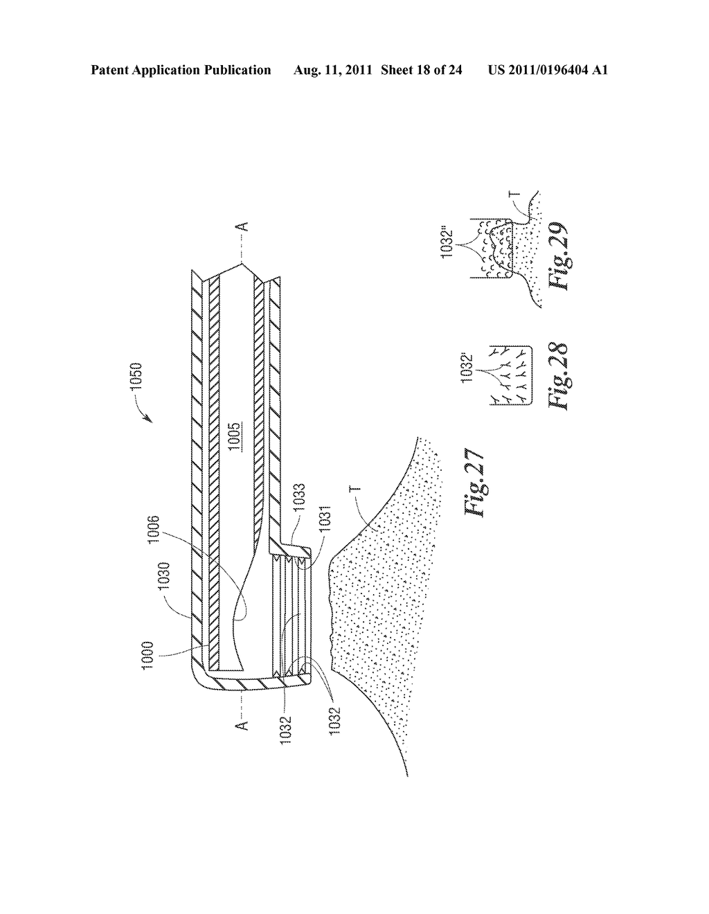 ULTRASONIC SURGICAL INSTRUMENTS WITH MOVING CUTTING IMPLEMENT - diagram, schematic, and image 19