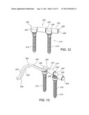 Method for stabilizing a spine diagram and image