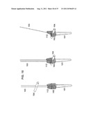 SYSTEM AND METHOD FOR WIRE-GUIDED PEDICLE SCREW STABILIZATION OF SPINAL     VERTEBRAE diagram and image