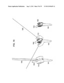 SYSTEM AND METHOD FOR WIRE-GUIDED PEDICLE SCREW STABILIZATION OF SPINAL     VERTEBRAE diagram and image