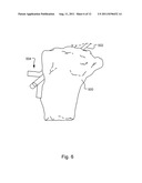 METHOD AND SYSTEM FOR COMPRESSION AND FIXATION OF TENDON TO BONE diagram and image