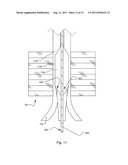 METHOD AND SYSTEM FOR COMPRESSION AND FIXATION OF TENDON TO BONE diagram and image