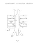 METHOD AND SYSTEM FOR COMPRESSION AND FIXATION OF TENDON TO BONE diagram and image