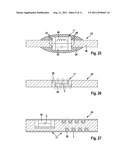 ELECTRODE DEVICE FOR ACTIVE MEDICAL IMPLANTS diagram and image