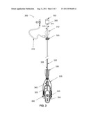 INTRAVASCULAR DEVICES FOR TREATING BLOOD VESSELS AND A METHOD OF USING     SUCH DEVICES diagram and image