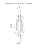 LASER ABLATED ELASTOMER SHEATH PROFILES TO ENABLE STENT SECUREMENT diagram and image