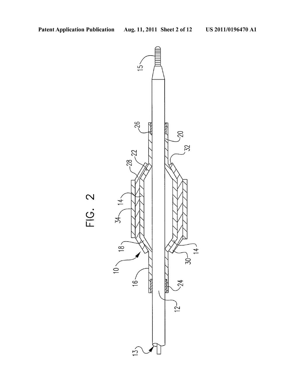 LASER ABLATED ELASTOMER SHEATH PROFILES TO ENABLE STENT SECUREMENT - diagram, schematic, and image 03