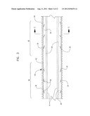 LASER ABLATED ELASTOMER SHEATH PROFILES TO ENABLE STENT SECUREMENT diagram and image