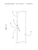 LASER ABLATED ELASTOMER SHEATH PROFILES TO ENABLE STENT SECUREMENT diagram and image