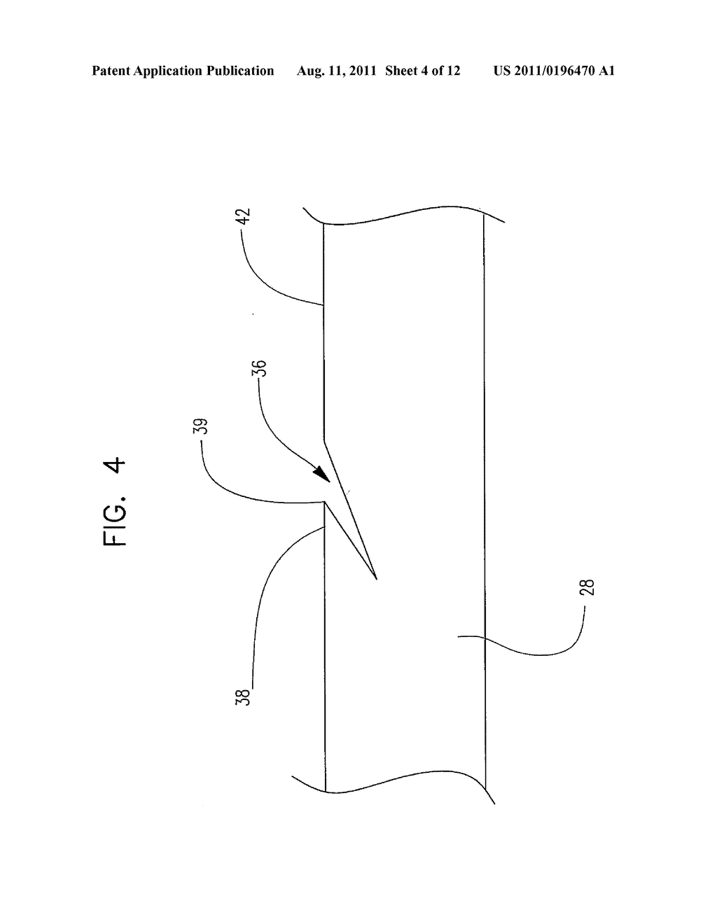 LASER ABLATED ELASTOMER SHEATH PROFILES TO ENABLE STENT SECUREMENT - diagram, schematic, and image 05