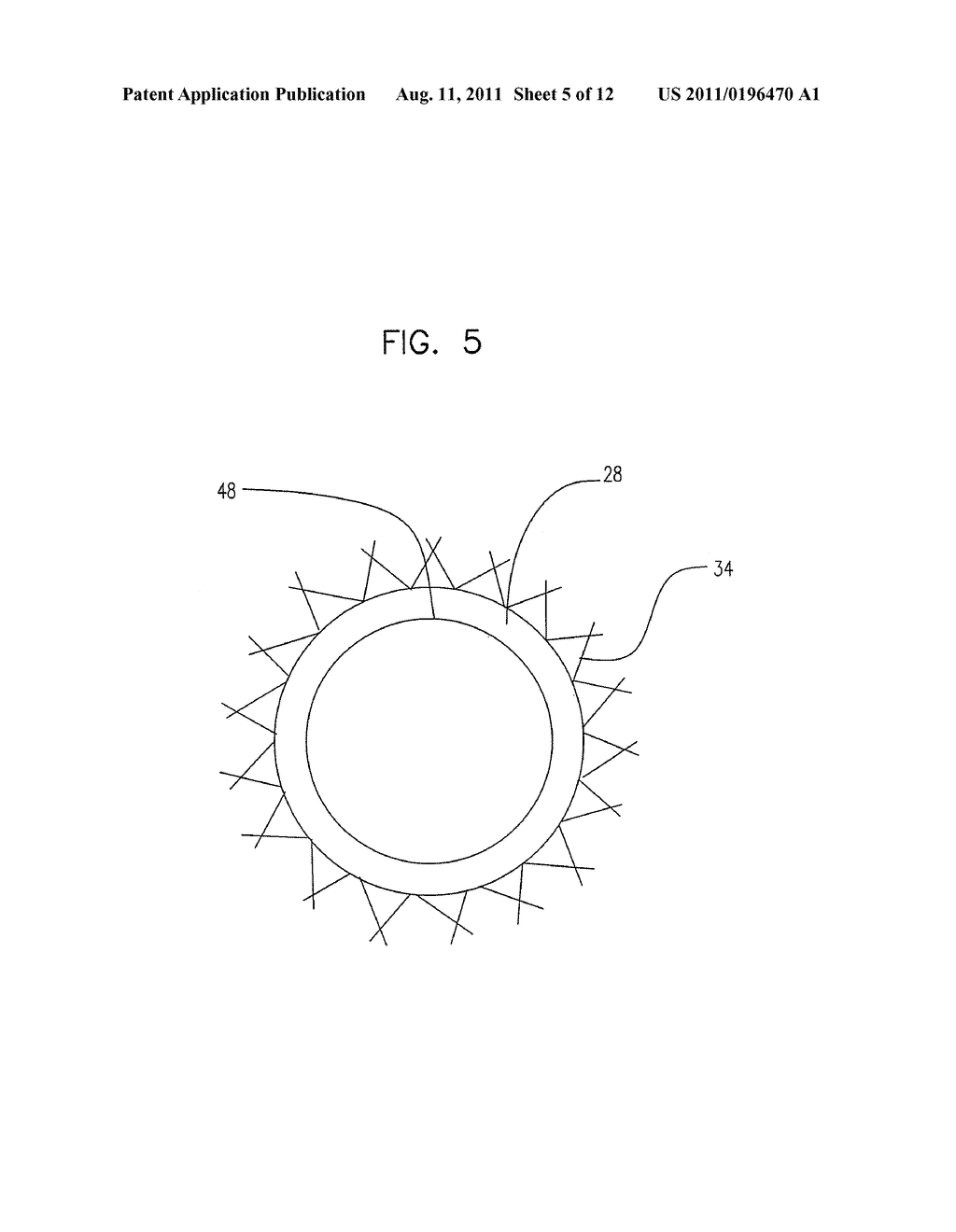 LASER ABLATED ELASTOMER SHEATH PROFILES TO ENABLE STENT SECUREMENT - diagram, schematic, and image 06