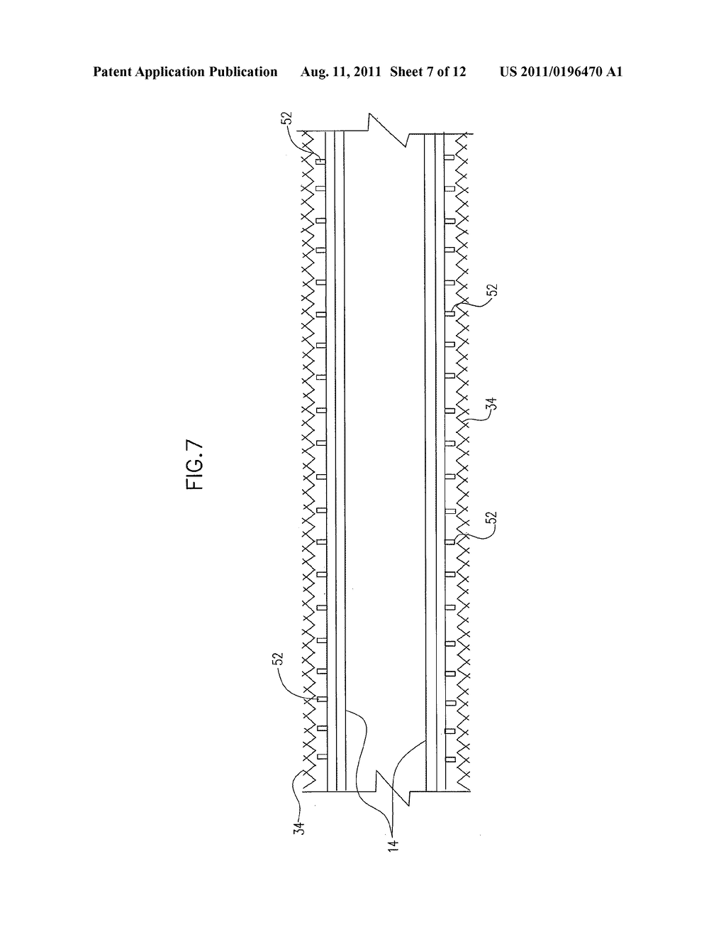 LASER ABLATED ELASTOMER SHEATH PROFILES TO ENABLE STENT SECUREMENT - diagram, schematic, and image 08