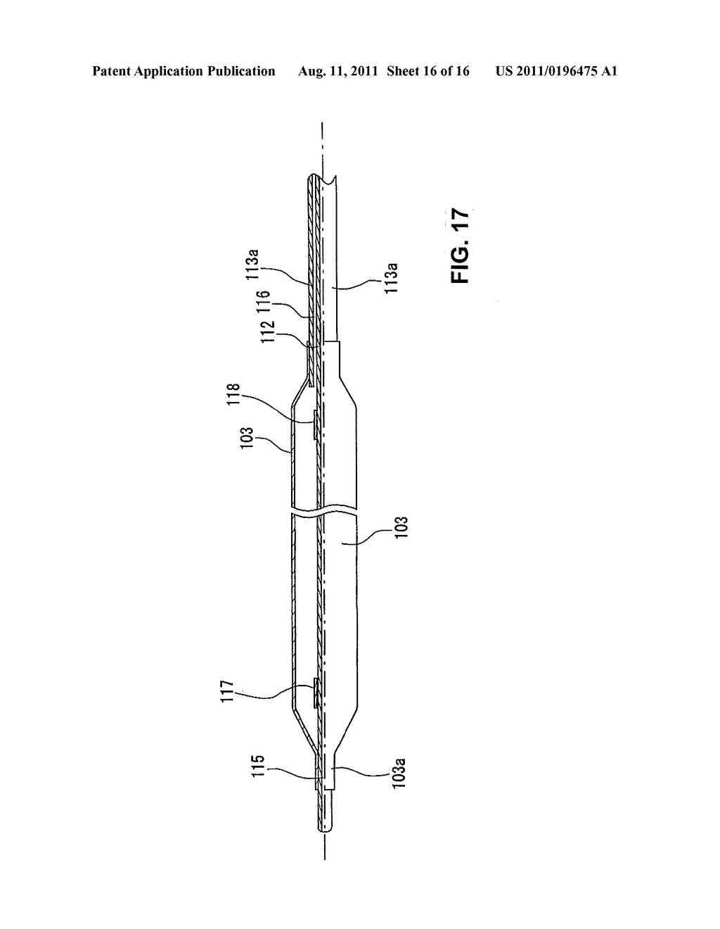 STENT FOR PLACEMENT IN LIVING BODY, AND STENT DELIVERY SYSTEM - diagram, schematic, and image 17