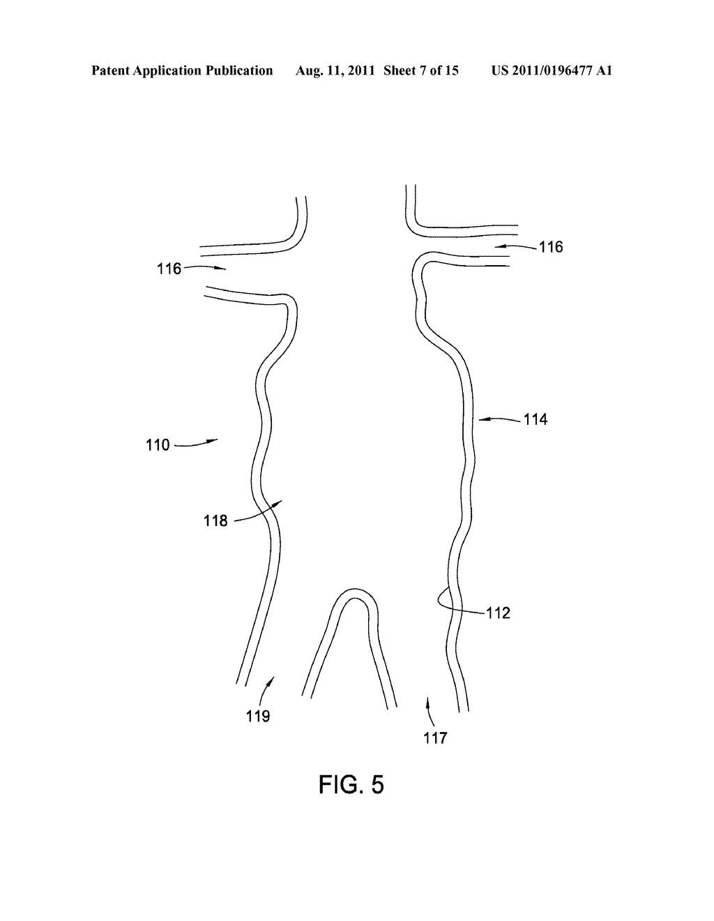 Methods and Apparatus for Treatment of Aneurysms Adjacent Branch Arteries - diagram, schematic, and image 08