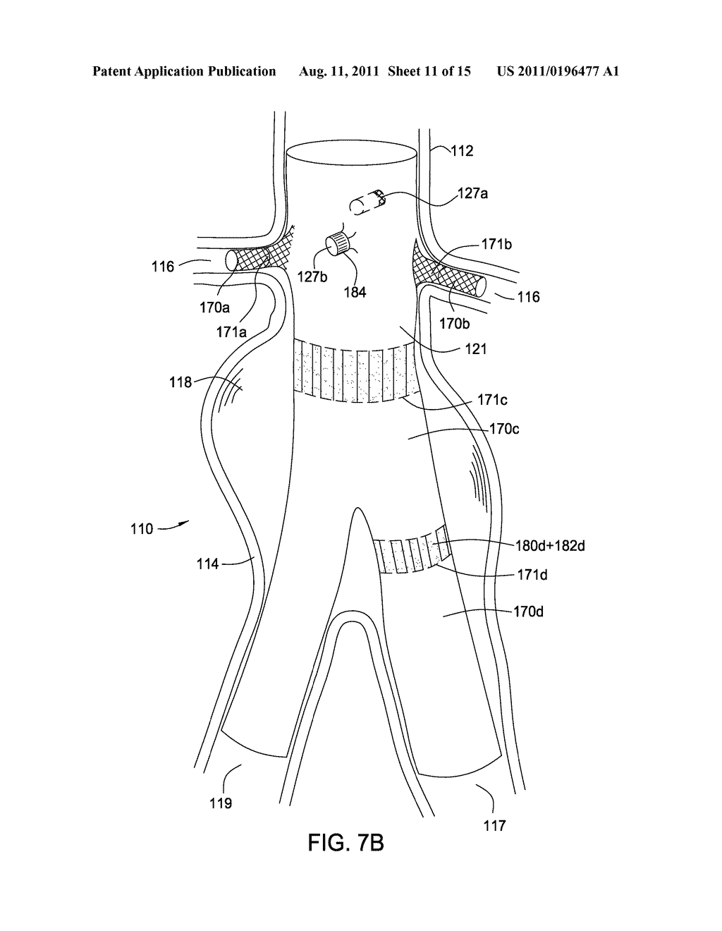 Methods and Apparatus for Treatment of Aneurysms Adjacent Branch Arteries - diagram, schematic, and image 12