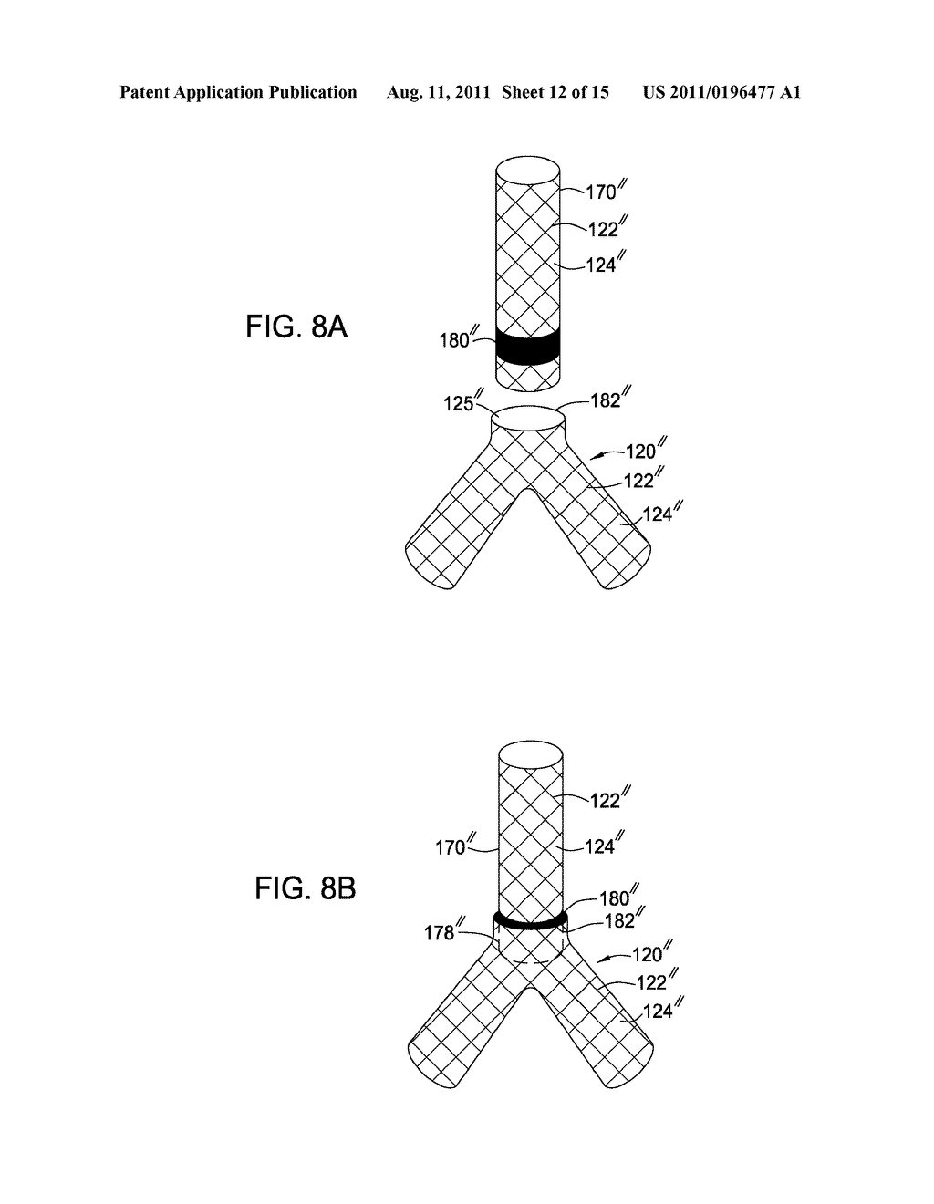 Methods and Apparatus for Treatment of Aneurysms Adjacent Branch Arteries - diagram, schematic, and image 13