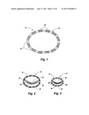 POST-OPERATIVE ADJUSTMENT TOOL, MINIMALLY INVASIVE ATTACHMENT APPARATUS,     AND ADJUSTABLE TRICUSPID RING diagram and image