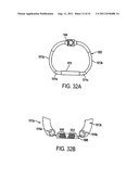 POST-OPERATIVE ADJUSTMENT TOOL, MINIMALLY INVASIVE ATTACHMENT APPARATUS,     AND ADJUSTABLE TRICUSPID RING diagram and image