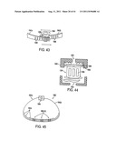 POST-OPERATIVE ADJUSTMENT TOOL, MINIMALLY INVASIVE ATTACHMENT APPARATUS,     AND ADJUSTABLE TRICUSPID RING diagram and image