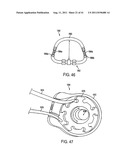 POST-OPERATIVE ADJUSTMENT TOOL, MINIMALLY INVASIVE ATTACHMENT APPARATUS,     AND ADJUSTABLE TRICUSPID RING diagram and image