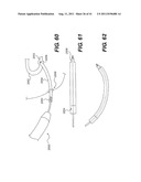 POST-OPERATIVE ADJUSTMENT TOOL, MINIMALLY INVASIVE ATTACHMENT APPARATUS,     AND ADJUSTABLE TRICUSPID RING diagram and image