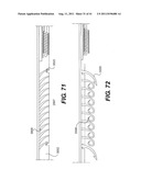 POST-OPERATIVE ADJUSTMENT TOOL, MINIMALLY INVASIVE ATTACHMENT APPARATUS,     AND ADJUSTABLE TRICUSPID RING diagram and image