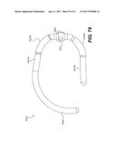 POST-OPERATIVE ADJUSTMENT TOOL, MINIMALLY INVASIVE ATTACHMENT APPARATUS,     AND ADJUSTABLE TRICUSPID RING diagram and image