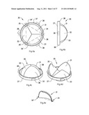 ARTIFICIAL VALVE diagram and image