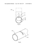 ARTIFICIAL VALVE diagram and image