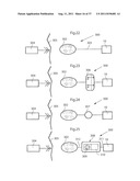 ARTIFICIAL VALVE diagram and image