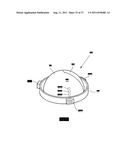 ARTIFICIAL VALVE diagram and image