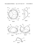 IMPROVED ARTIFICIAL VALVE diagram and image