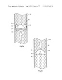 IMPROVED ARTIFICIAL VALVE diagram and image