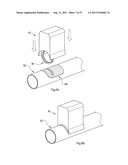 IMPROVED ARTIFICIAL VALVE diagram and image