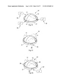 IMPROVED ARTIFICIAL VALVE diagram and image