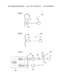 IMPROVED ARTIFICIAL VALVE diagram and image