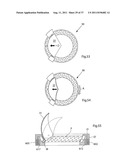 IMPROVED ARTIFICIAL VALVE diagram and image