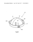 IMPROVED ARTIFICIAL VALVE diagram and image