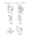 BONE PROSTHESIS diagram and image