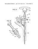 BONE PROSTHESIS diagram and image