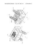 CAGE SYSTEM TO ANTERIOR LUMBAR INTERVERTEBRAL FUSION diagram and image