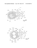 SYSTEMS AND METHODS FOR TREATING VERTEBRAL BODIES diagram and image