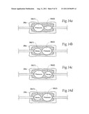 SYSTEMS AND METHODS FOR TREATING VERTEBRAL BODIES diagram and image